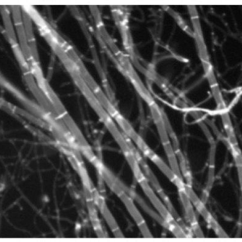 hyphae