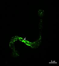 Focalization of Lifeact-GFP (actin marker) upon cell contact (arrow) in germlings of Neurospora crassa.